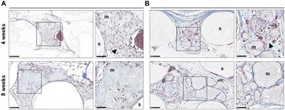 Ectopic Bone Tissue Engineering in Mice Using Human Gingiva or Bone Marrow-Derived Stromal/Progenitor Cells in Scaffold-Hydrogel Constructs